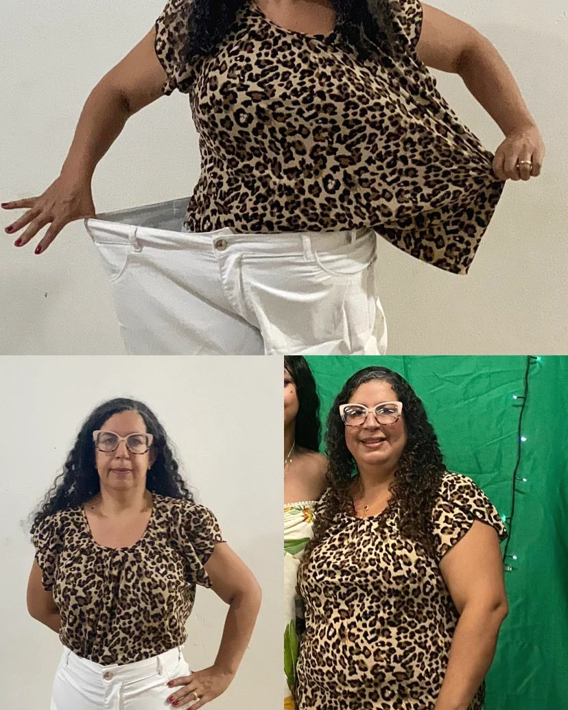Paciente mostrando a calça antiga, larga após o emagrecimento