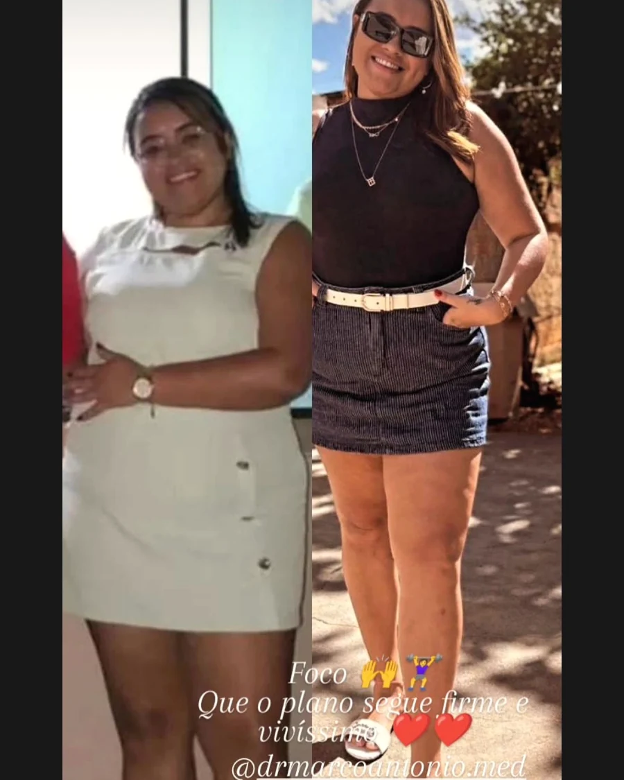 Comparativo de evolução enviado pela paciente